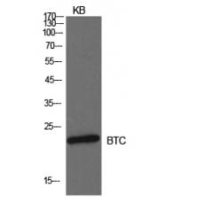 Anti-Probetacellulin antibody