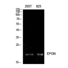 Anti-Epigen antibody