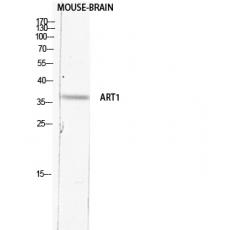 Anti-CD296 antibody