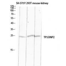 Anti-TP53INP2 antibody