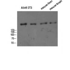 Anti-CD35 antibody