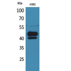 Anti-PSG1 antibody