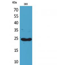 Anti-Lymphotactin antibody