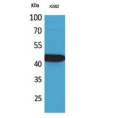 Anti-Fractalkine antibody