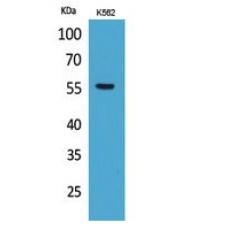 Anti-Glut5 antibody