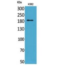 Anti-CD169 antibody