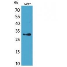 Anti-KLK1 antibody