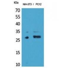 Anti-DcR1 antibody