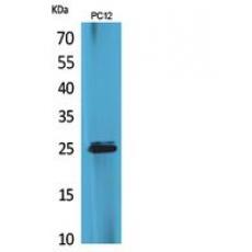 Anti-CMTM5 antibody