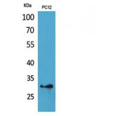 Anti-HLA-DQB1/2 antibody