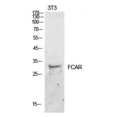 Anti-CD89 antibody