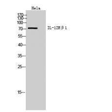 Anti-IL-12Rβ1 antibody