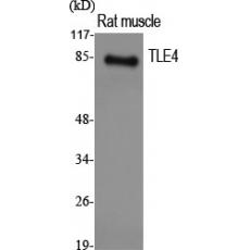 Anti-TLE4 antibody