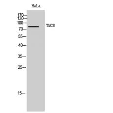 Anti-TMC8 antibody