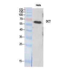 Anti-TRP2 antibody