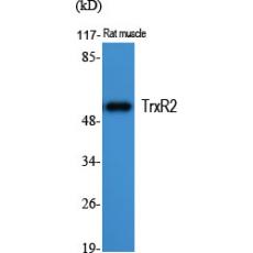 Anti-TrxR2 antibody