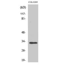 Anti-UBCE7IP4 antibody