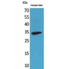 Anti-Hepassocin antibody