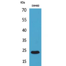 Anti-FGF-9 antibody