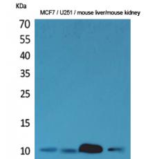 Anti-ACBP antibody