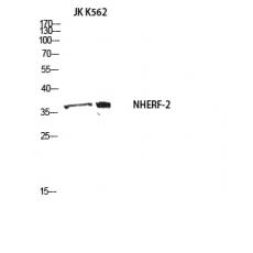 Anti-NHERF-2 antibody