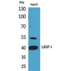 Anti-LASP-1 antibody