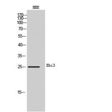 Anti-Ebi3 antibody