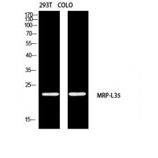 Anti-MRP-L35 antibody