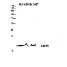 Anti-IL-1F5 antibody