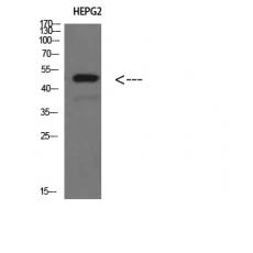 Anti-TRAF1 antibody