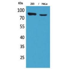 Anti-DRA antibody