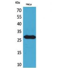 Anti-SNRPN antibody