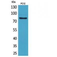 Anti-CD239 antibody