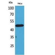 Anti-D3DR antibody