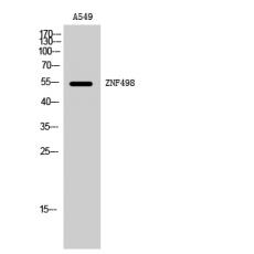 Anti-ZNF498 antibody