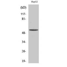 Anti-TMEM145 antibody