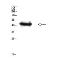 Anti-RCC1 antibody