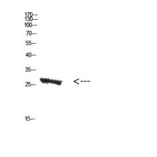 Anti-MBL-C antibody