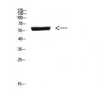 Anti-CYP26B1 antibody