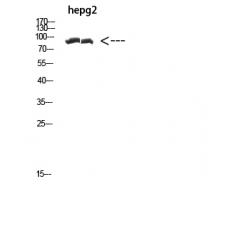 Anti-CACTIN antibody