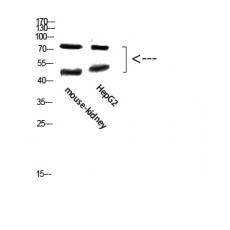 Anti-TMPO antibody