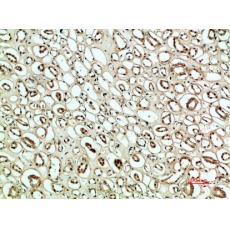 Anti-PLK2 antibody