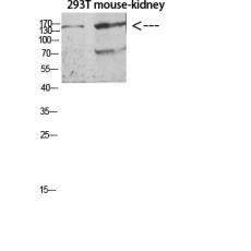 Anti-Flt-4 antibody