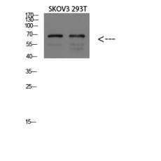 Anti-GADD34 antibody