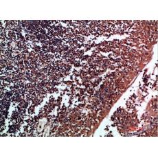 Anti-Tenascin-R antibody