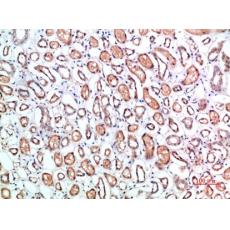 Anti-CD1B antibody