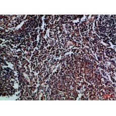 Anti-CD70 antibody