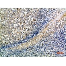 Anti-ATG10 antibody