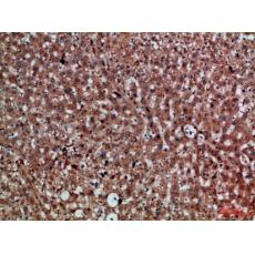 Anti-CDNF antibody