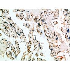 Anti-IFN-β antibody